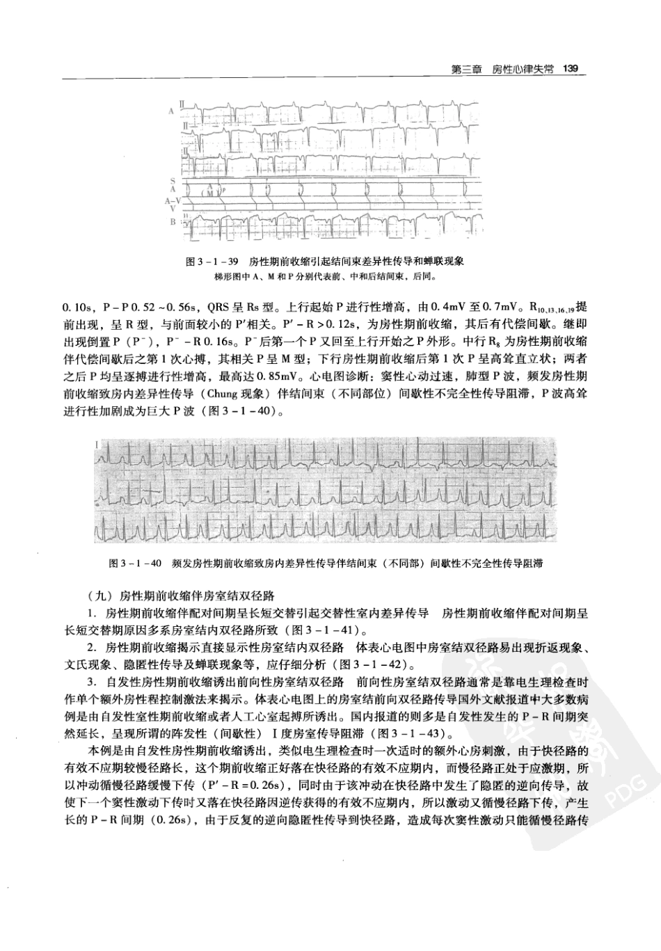 实用心律失常学：1100例心电图个案临床分析  第2版_中国协和医科大学出版社_2008.10_夏宏器，邓开伯主编_151-200.pdf_第1页