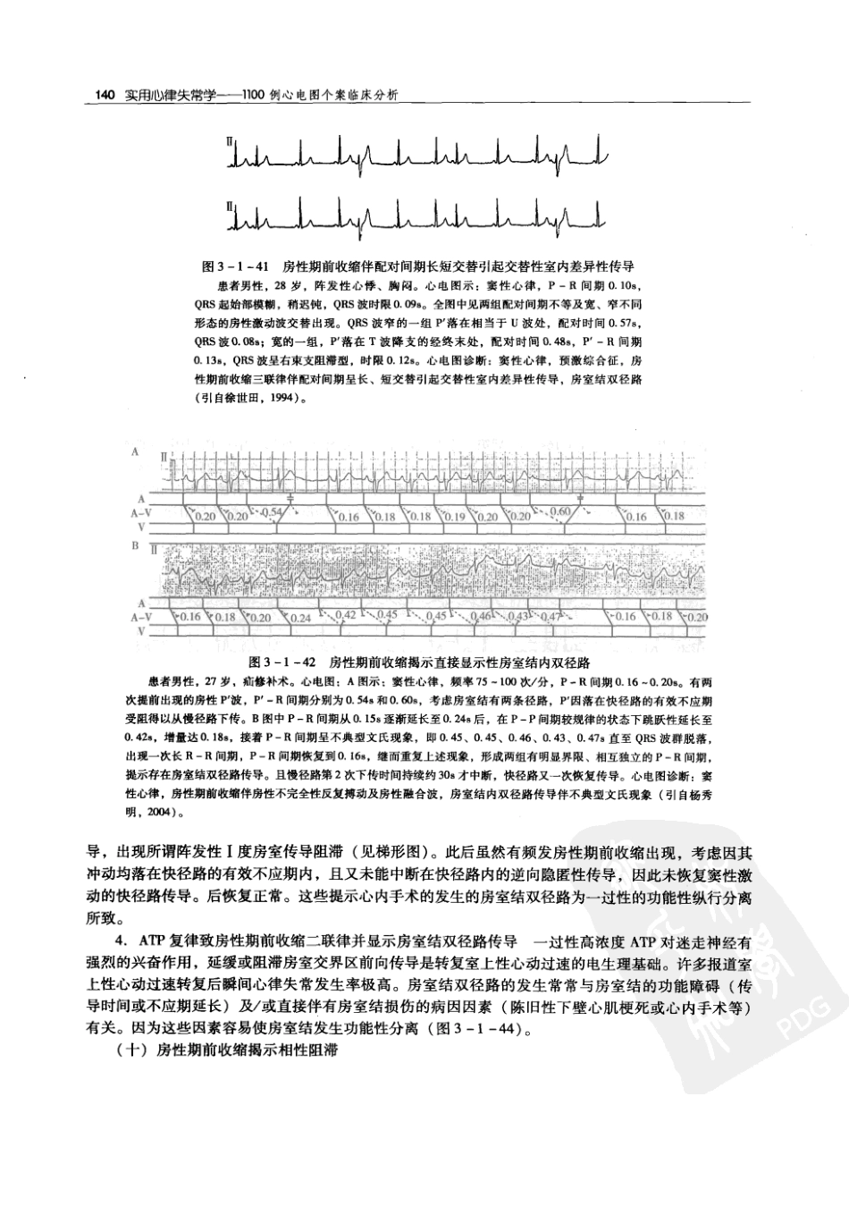 实用心律失常学：1100例心电图个案临床分析  第2版_中国协和医科大学出版社_2008.10_夏宏器，邓开伯主编_151-200.pdf_第2页