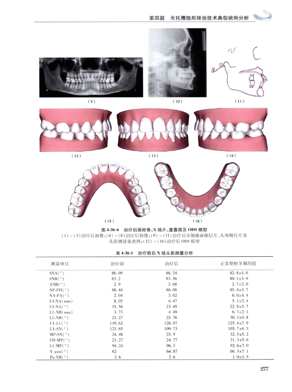 口腔正畸现代无托槽隐形矫治技术 田杰著 2014_289-300.pdf_第3页