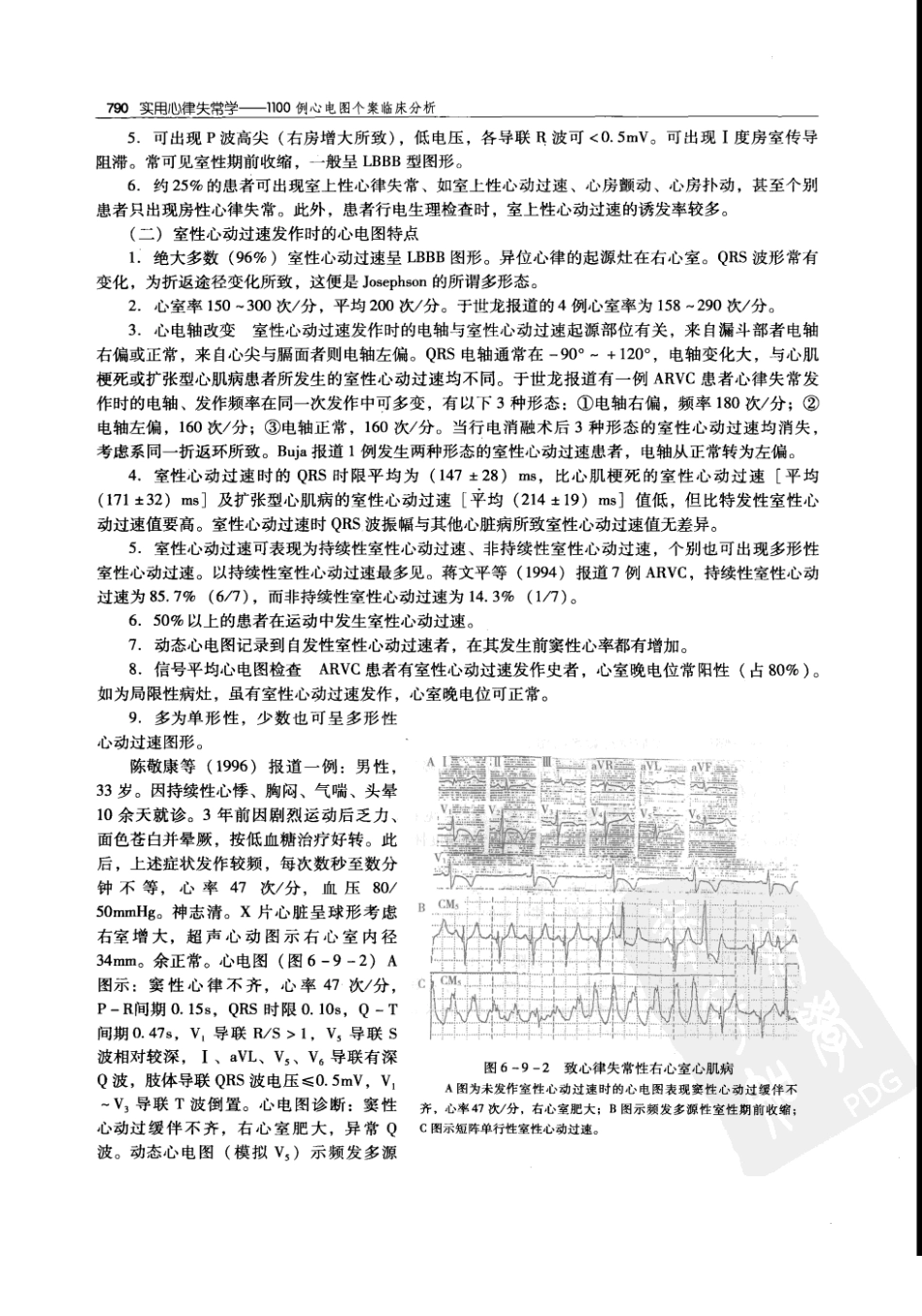 实用心律失常学：1100例心电图个案临床分析  第2版_中国协和医科大学出版社_2008.10_夏宏器，邓开伯主编_801-850.pdf_第2页