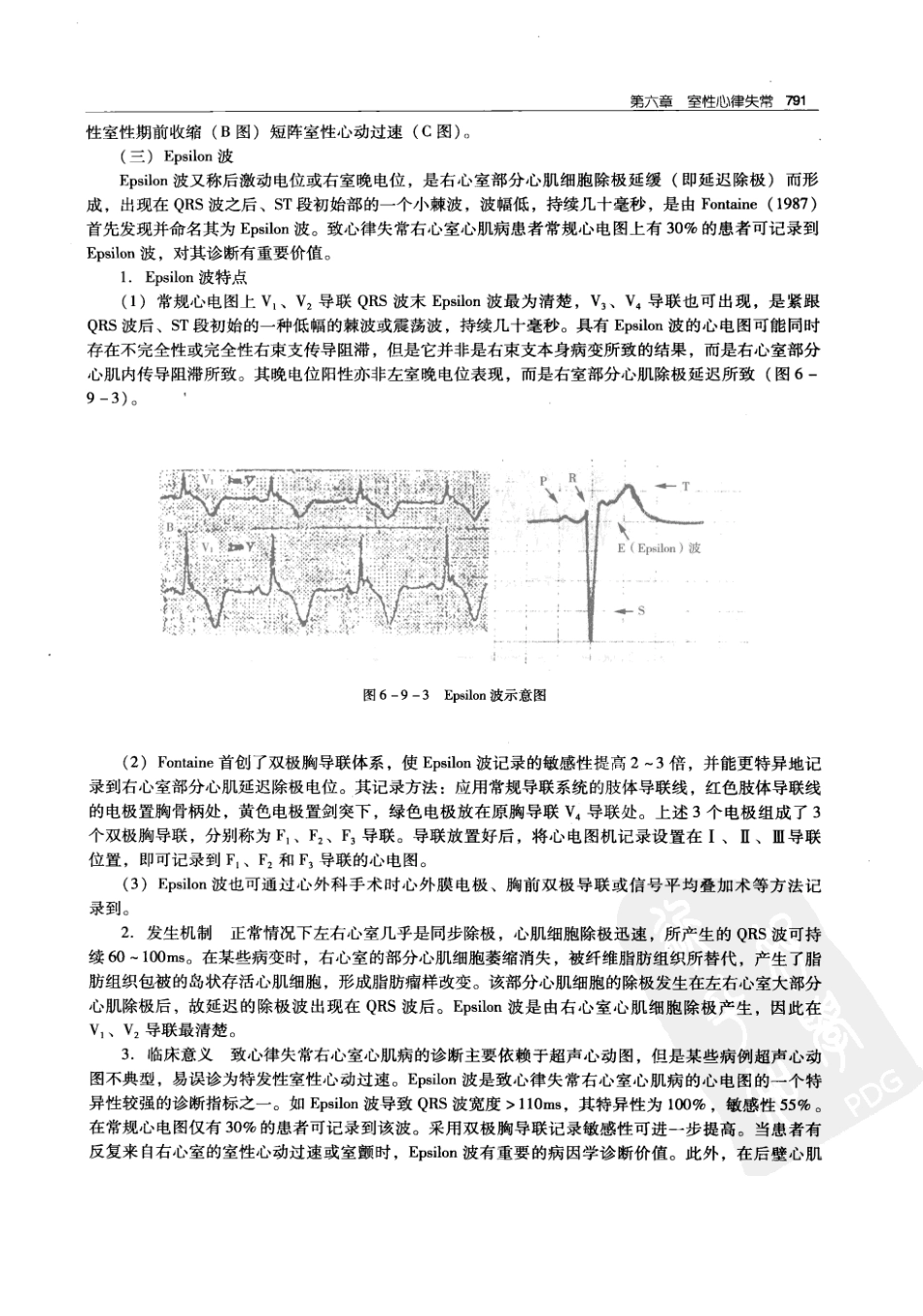 实用心律失常学：1100例心电图个案临床分析  第2版_中国协和医科大学出版社_2008.10_夏宏器，邓开伯主编_801-850.pdf_第3页
