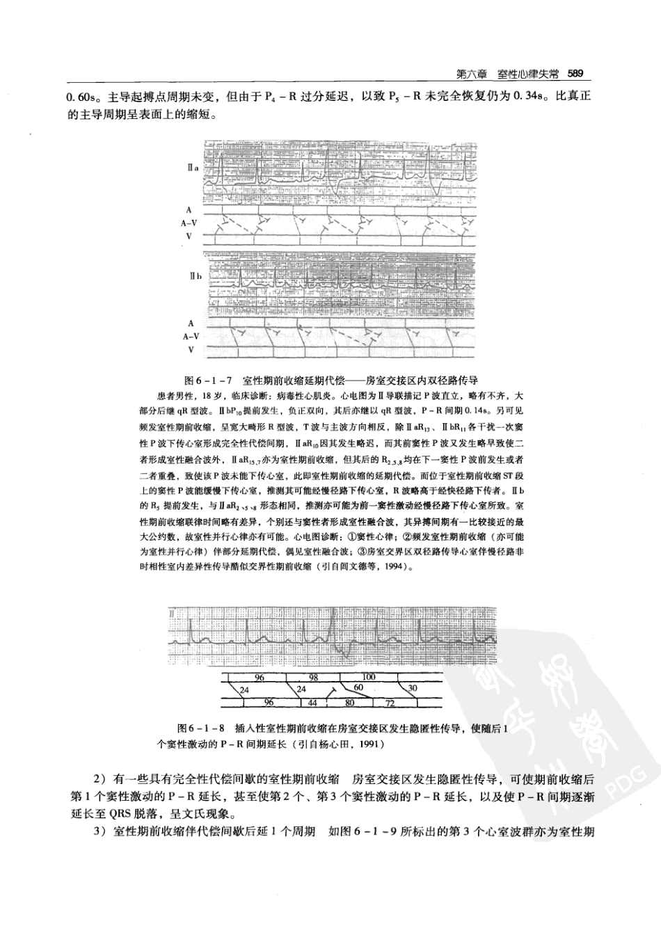 实用心律失常学：1100例心电图个案临床分析  第2版_中国协和医科大学出版社_2008.10_夏宏器，邓开伯主编_601-650.pdf_第1页
