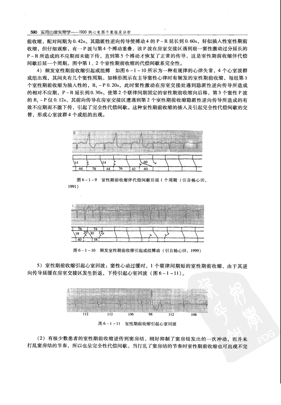 实用心律失常学：1100例心电图个案临床分析  第2版_中国协和医科大学出版社_2008.10_夏宏器，邓开伯主编_601-650.pdf_第2页