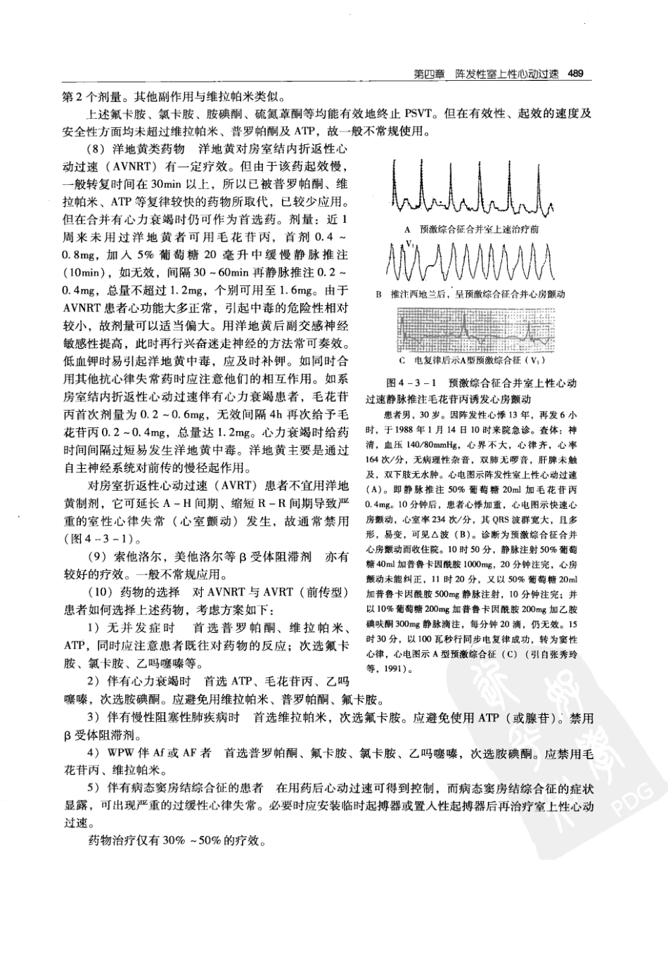 实用心律失常学：1100例心电图个案临床分析  第2版_中国协和医科大学出版社_2008.10_夏宏器，邓开伯主编_501-550.pdf_第1页