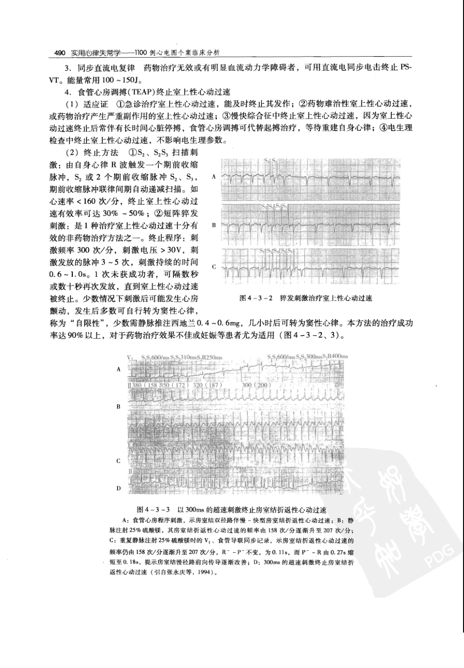 实用心律失常学：1100例心电图个案临床分析  第2版_中国协和医科大学出版社_2008.10_夏宏器，邓开伯主编_501-550.pdf_第2页