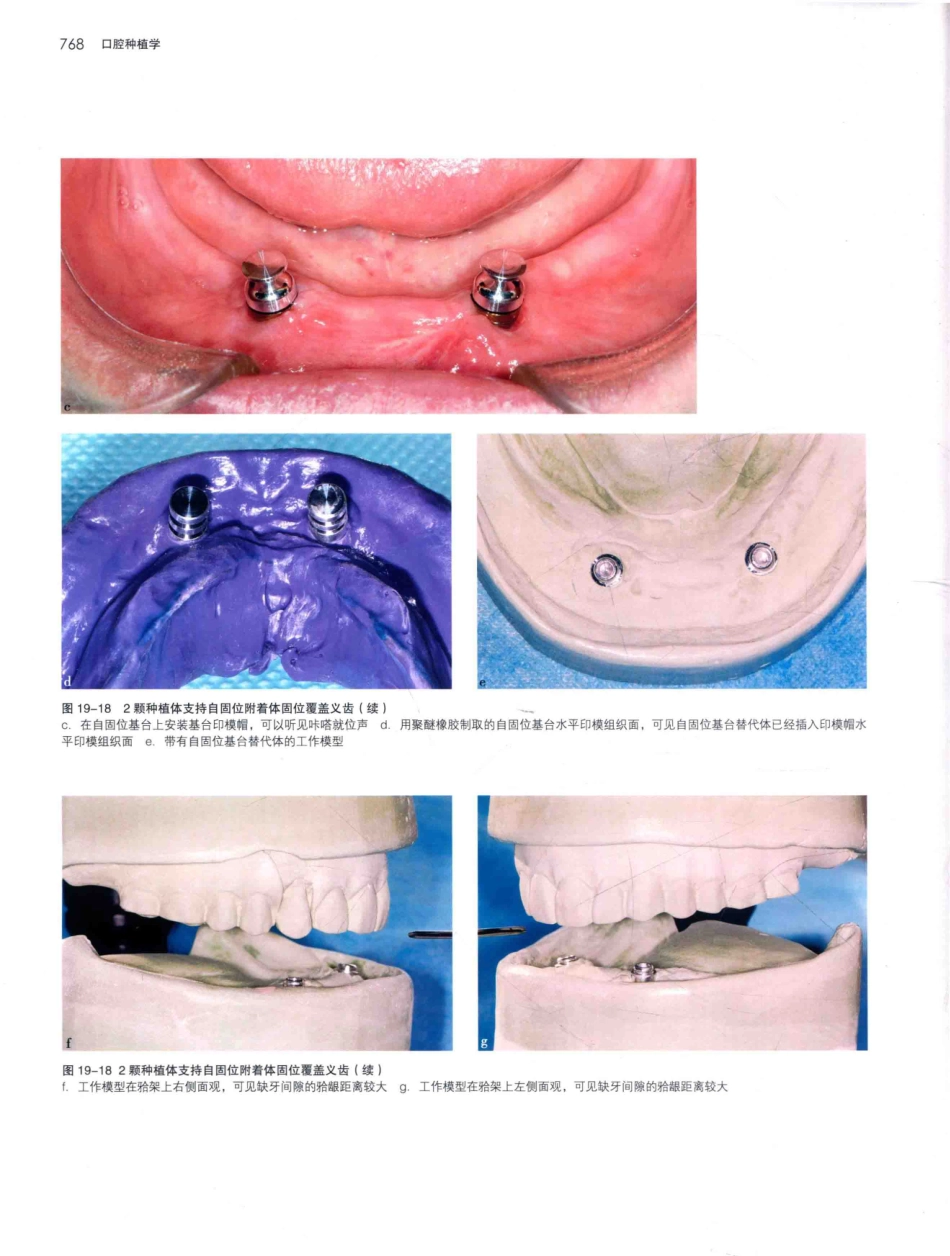口腔种植学（第2版）_宿玉成主编_2014年（彩图）_811-840.pdf_第1页