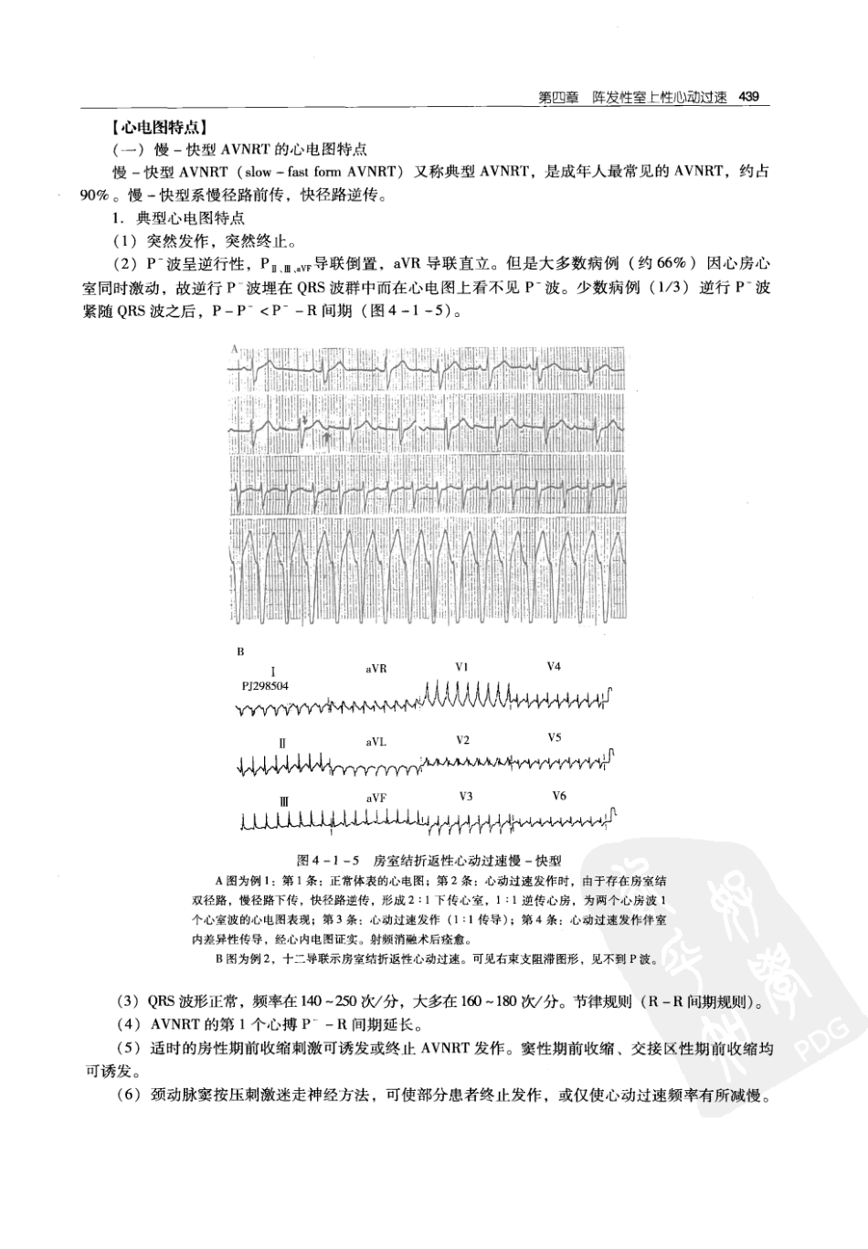 实用心律失常学：1100例心电图个案临床分析  第2版_中国协和医科大学出版社_2008.10_夏宏器，邓开伯主编_451-500.pdf_第1页