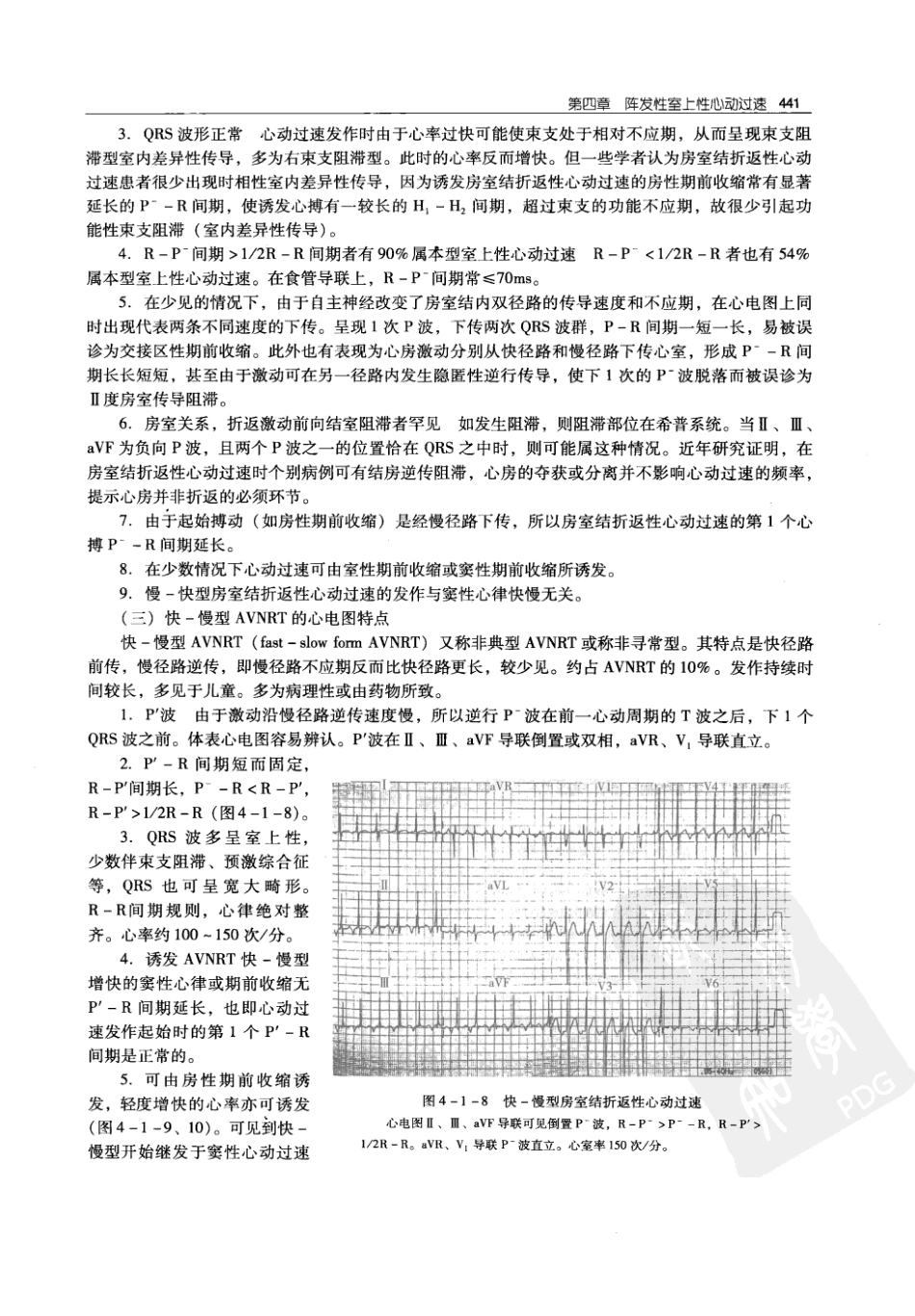 实用心律失常学：1100例心电图个案临床分析  第2版_中国协和医科大学出版社_2008.10_夏宏器，邓开伯主编_451-500.pdf_第3页