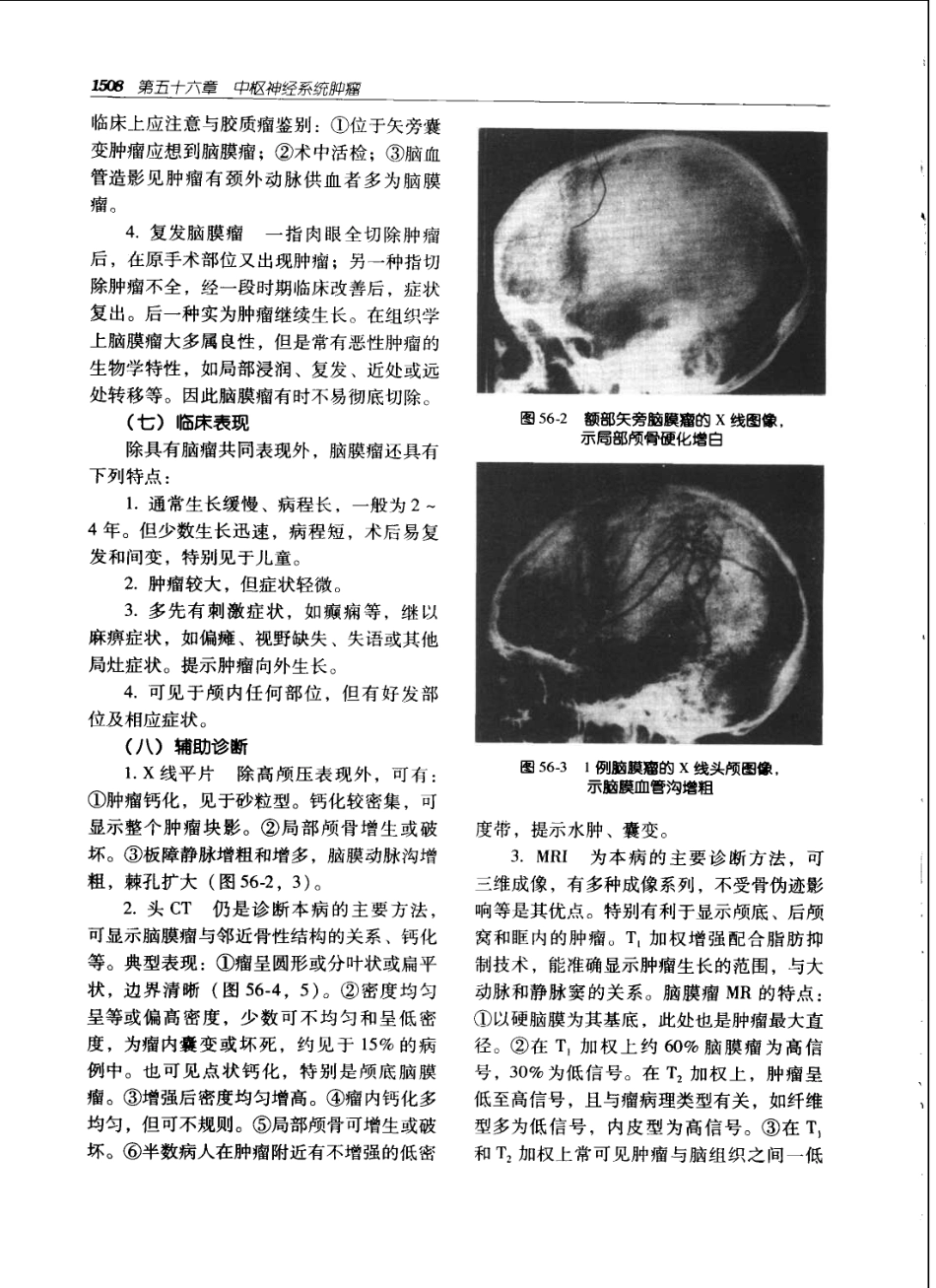 实用外科学（第2版）上下册_1541-1650.pdf_第3页