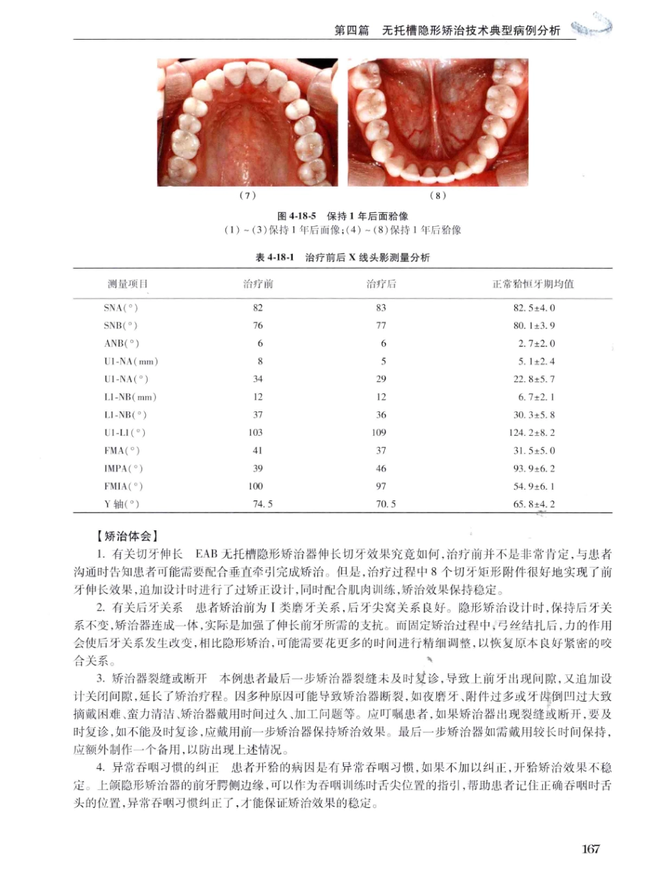口腔正畸现代无托槽隐形矫治技术 田杰著 2014_181-192.pdf_第1页