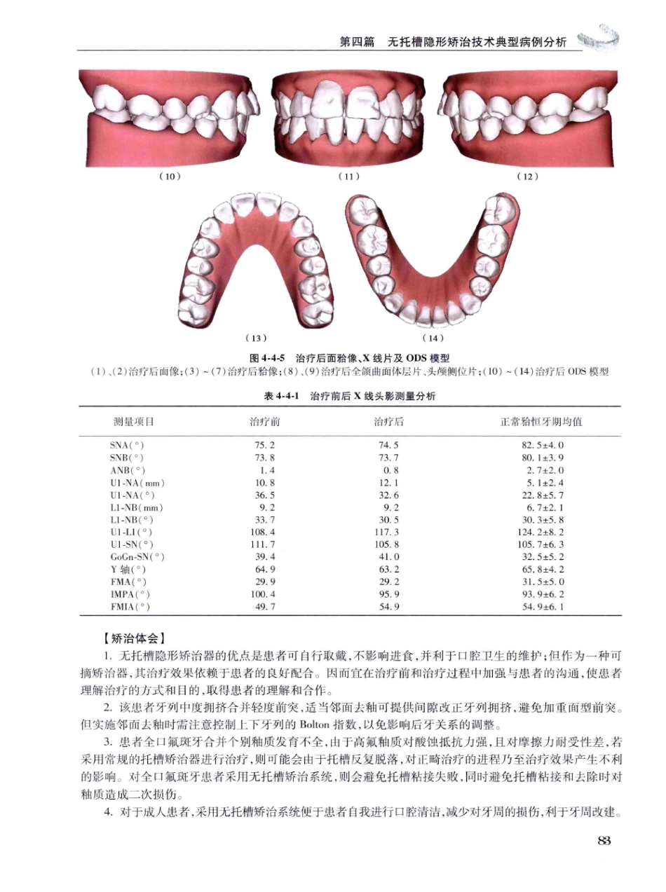 口腔正畸现代无托槽隐形矫治技术 田杰著 2014_97-108.pdf_第1页