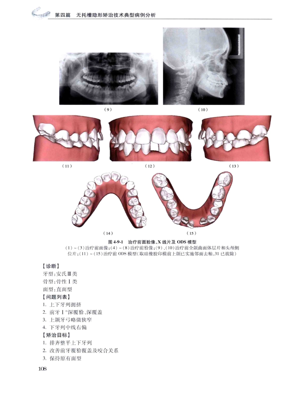 口腔正畸现代无托槽隐形矫治技术 田杰著 2014_121-132.pdf_第2页