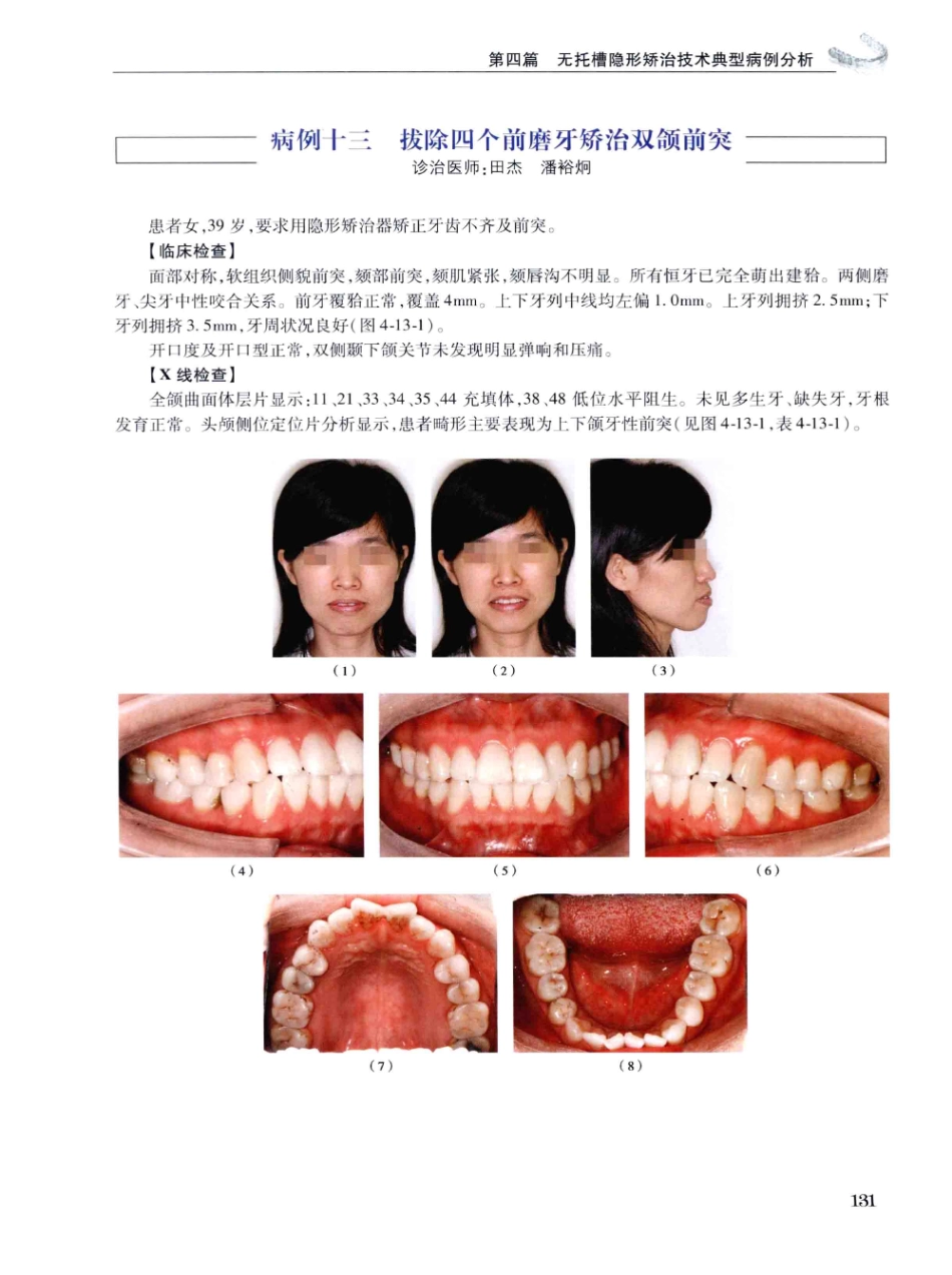 口腔正畸现代无托槽隐形矫治技术 田杰著 2014_145-156.pdf_第1页