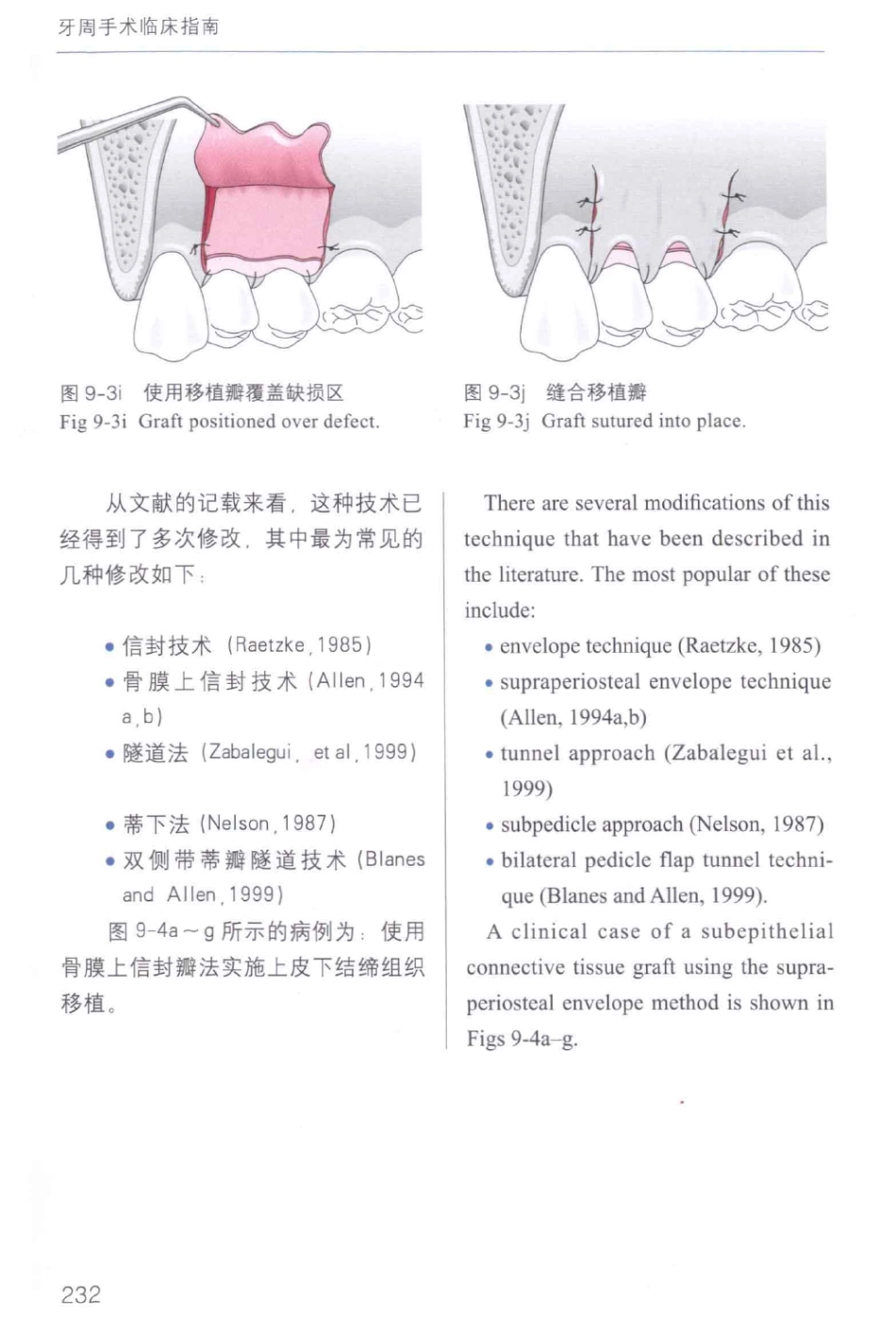 牙周手术临床指南 中英文对照_俞雪芬2013（彩图）_241-252.pdf_第2页