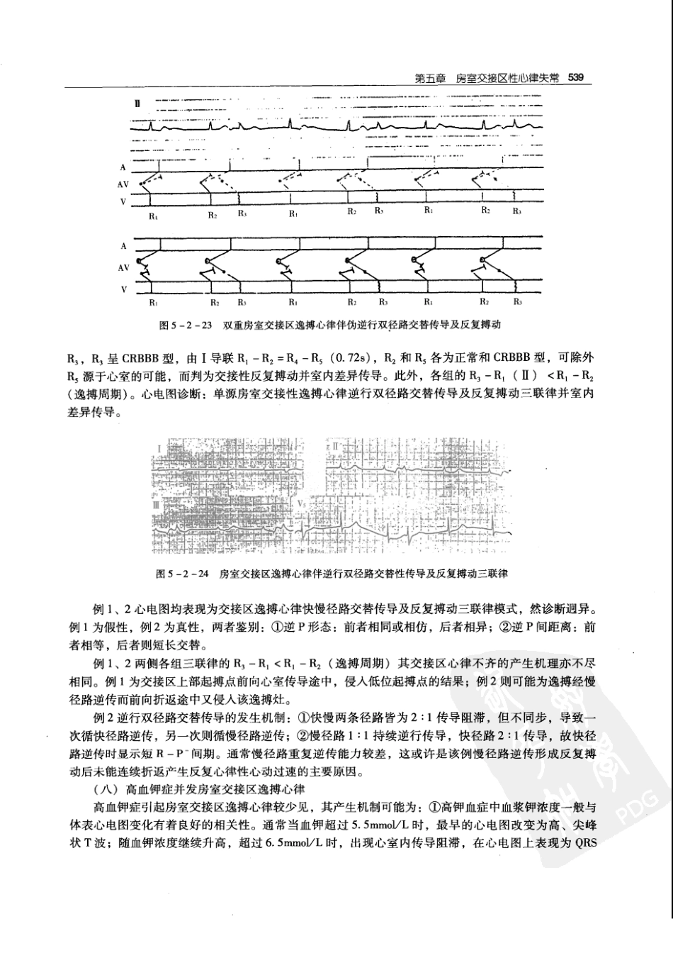 实用心律失常学：1100例心电图个案临床分析  第2版_中国协和医科大学出版社_2008.10_夏宏器，邓开伯主编_551-600.pdf_第1页