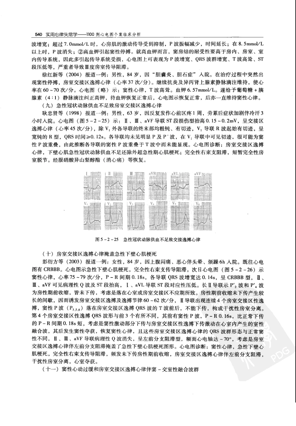 实用心律失常学：1100例心电图个案临床分析  第2版_中国协和医科大学出版社_2008.10_夏宏器，邓开伯主编_551-600.pdf_第2页