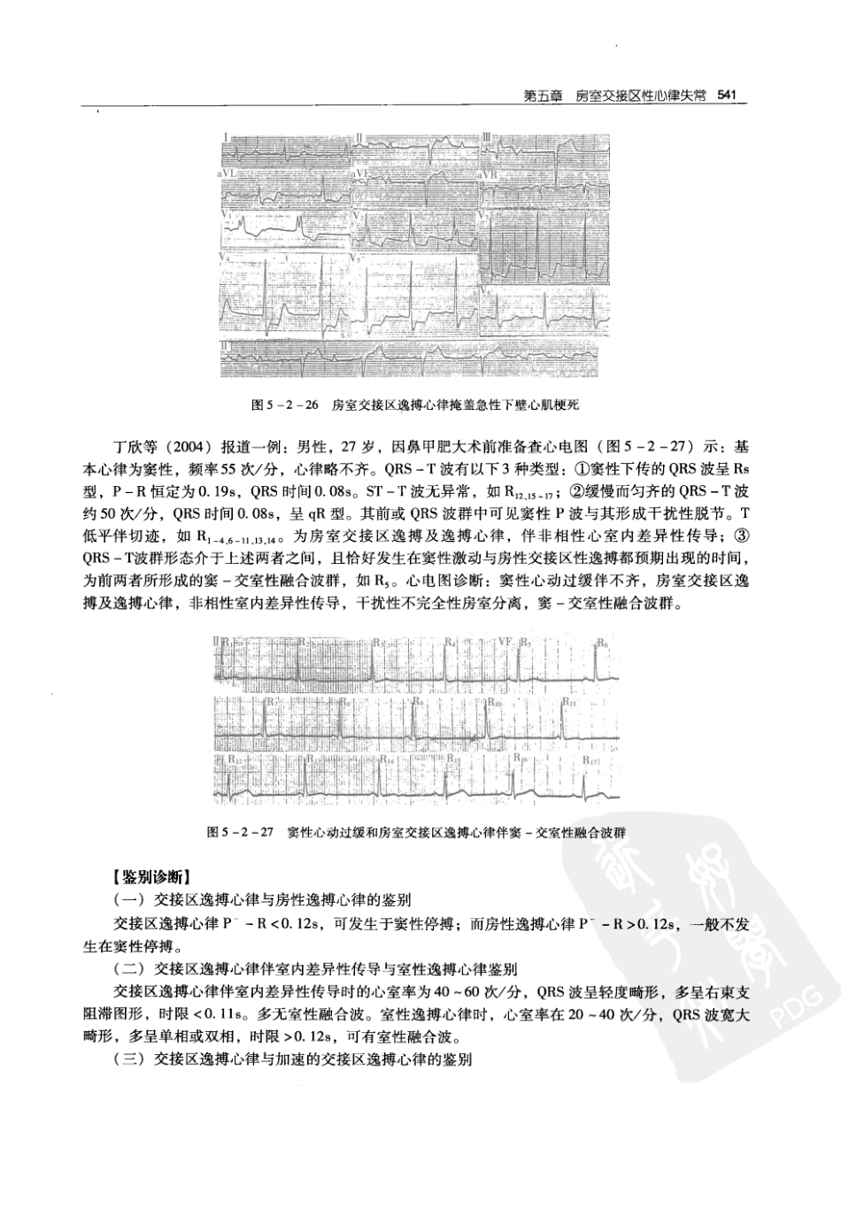 实用心律失常学：1100例心电图个案临床分析  第2版_中国协和医科大学出版社_2008.10_夏宏器，邓开伯主编_551-600.pdf_第3页