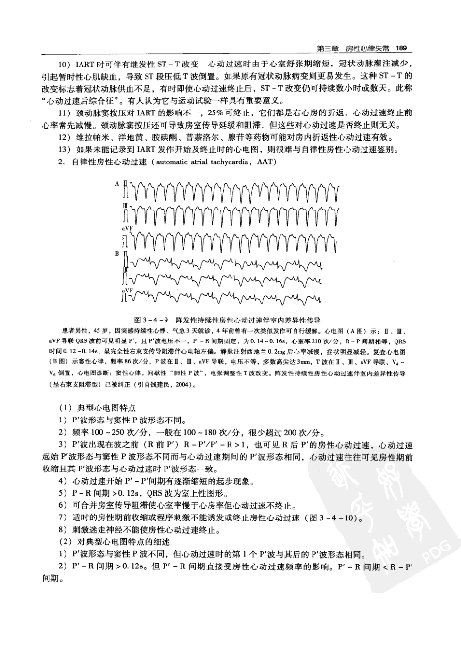 实用心律失常学：1100例心电图个案临床分析  第2版_中国协和医科大学出版社_2008.10_夏宏器，邓开伯主编_201-250.pdf_第1页