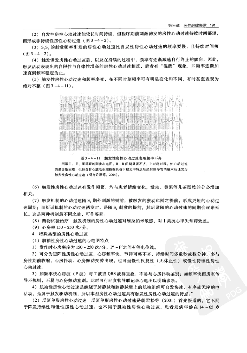 实用心律失常学：1100例心电图个案临床分析  第2版_中国协和医科大学出版社_2008.10_夏宏器，邓开伯主编_201-250.pdf_第3页