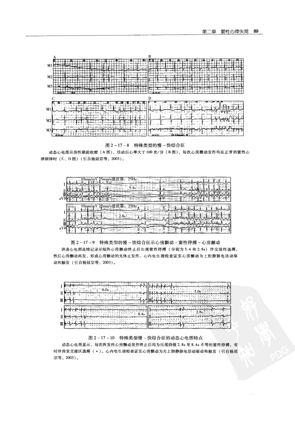实用心律失常学：1100例心电图个案临床分析  第2版_中国协和医科大学出版社_2008.10_夏宏器，邓开伯主编_101-150.pdf_第1页