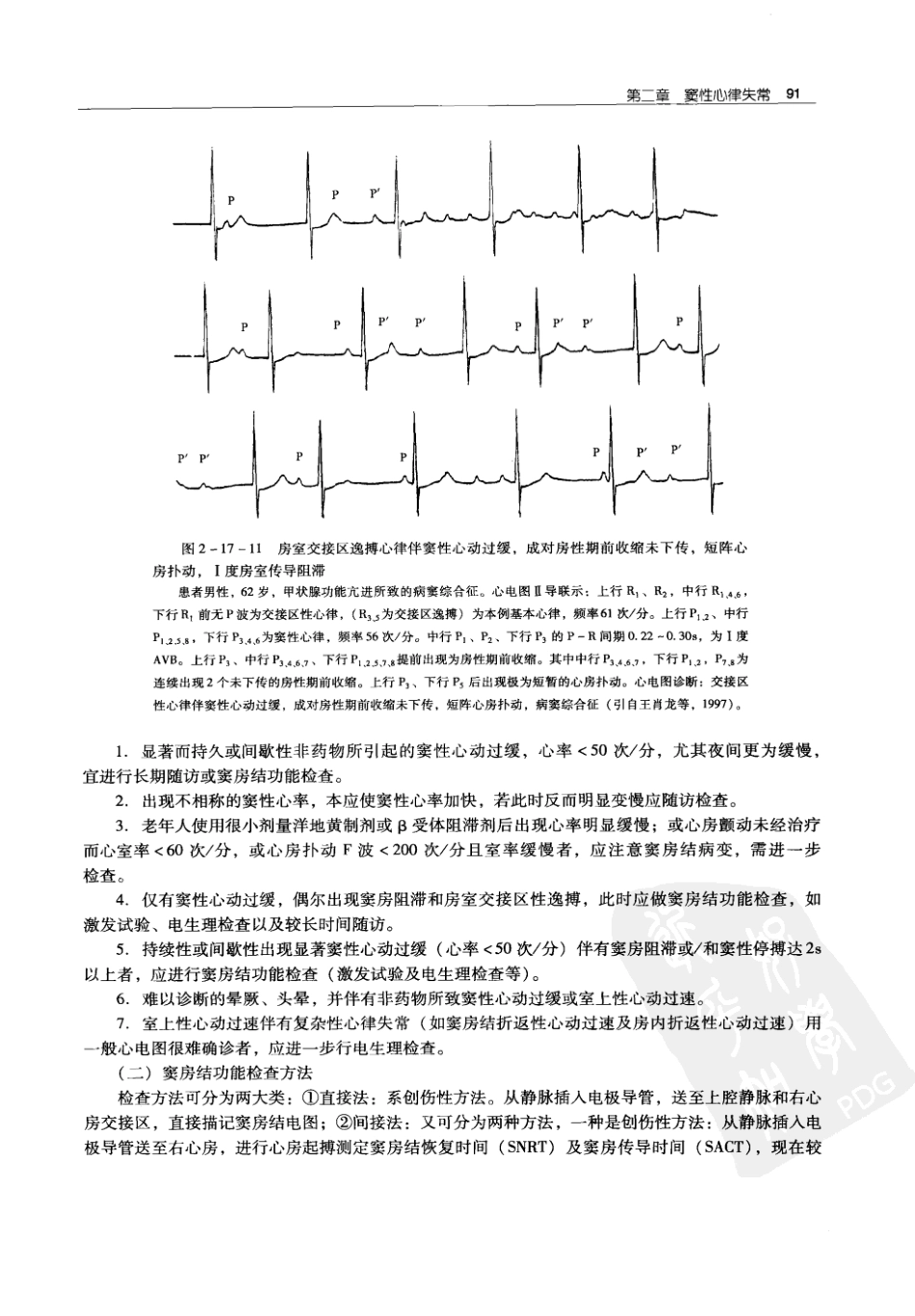 实用心律失常学：1100例心电图个案临床分析  第2版_中国协和医科大学出版社_2008.10_夏宏器，邓开伯主编_101-150.pdf_第3页