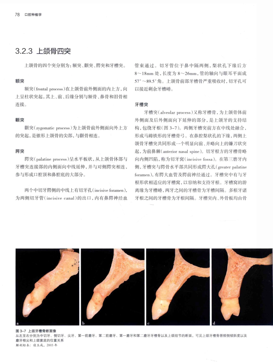 口腔种植学（第2版）_宿玉成主编_2014年（彩图）_121-150.pdf_第1页