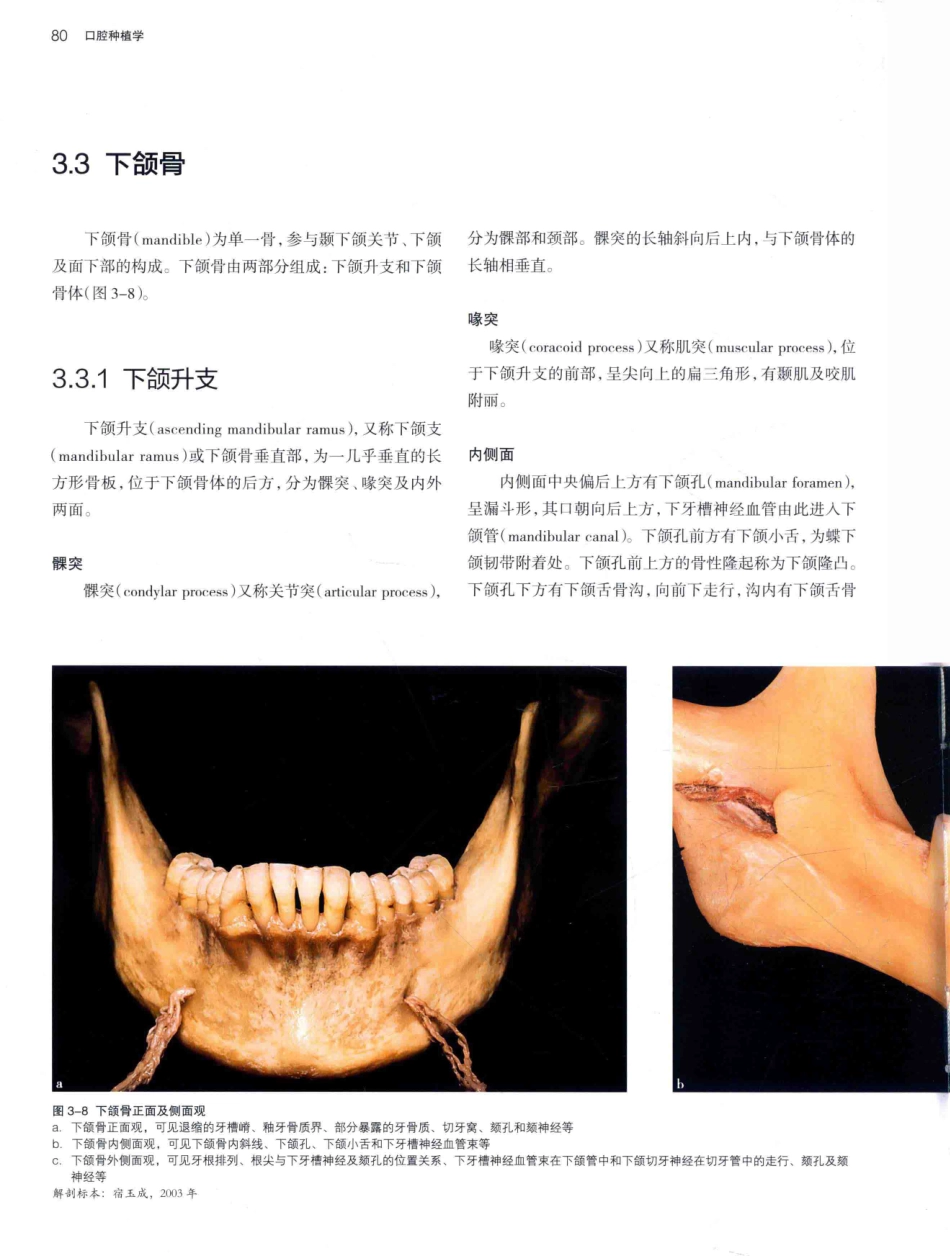 口腔种植学（第2版）_宿玉成主编_2014年（彩图）_121-150.pdf_第3页