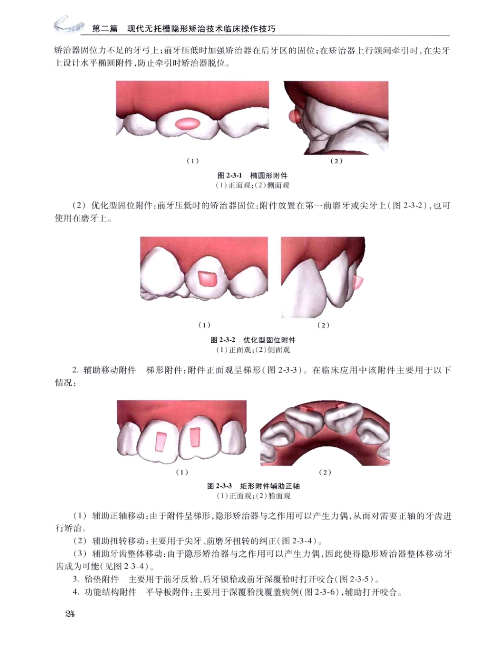 口腔正畸现代无托槽隐形矫治技术 田杰著 2014_37-48.pdf_第2页