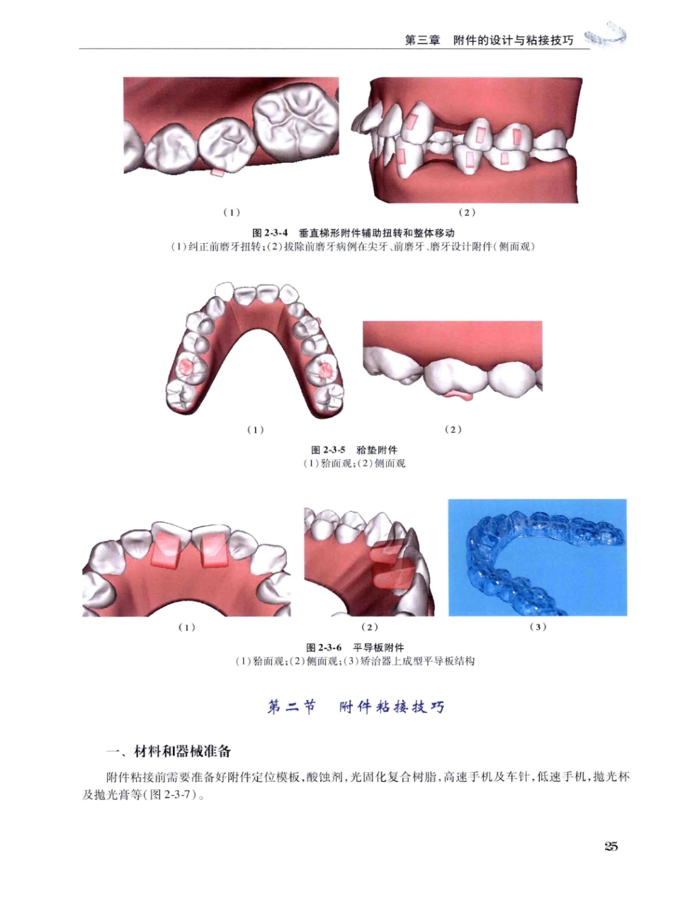 口腔正畸现代无托槽隐形矫治技术 田杰著 2014_37-48.pdf_第3页
