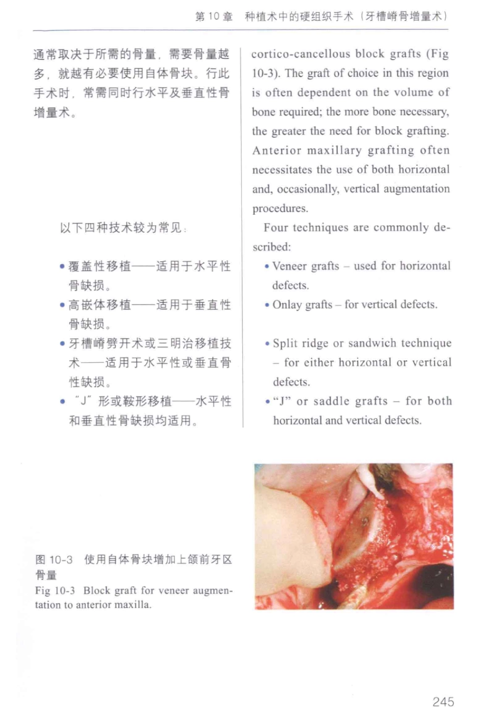 牙周手术临床指南 中英文对照_俞雪芬2013（彩图）_253-264.pdf_第3页