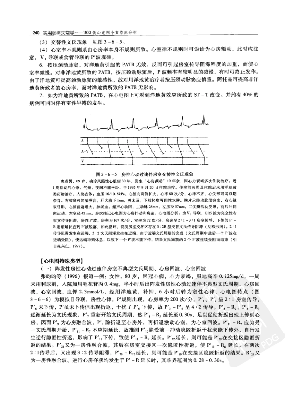 实用心律失常学：1100例心电图个案临床分析  第2版_中国协和医科大学出版社_2008.10_夏宏器，邓开伯主编_251-300.pdf_第2页