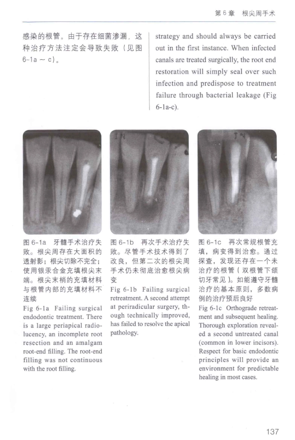 牙周手术临床指南 中英文对照_俞雪芬2013（彩图）_145-156.pdf_第3页