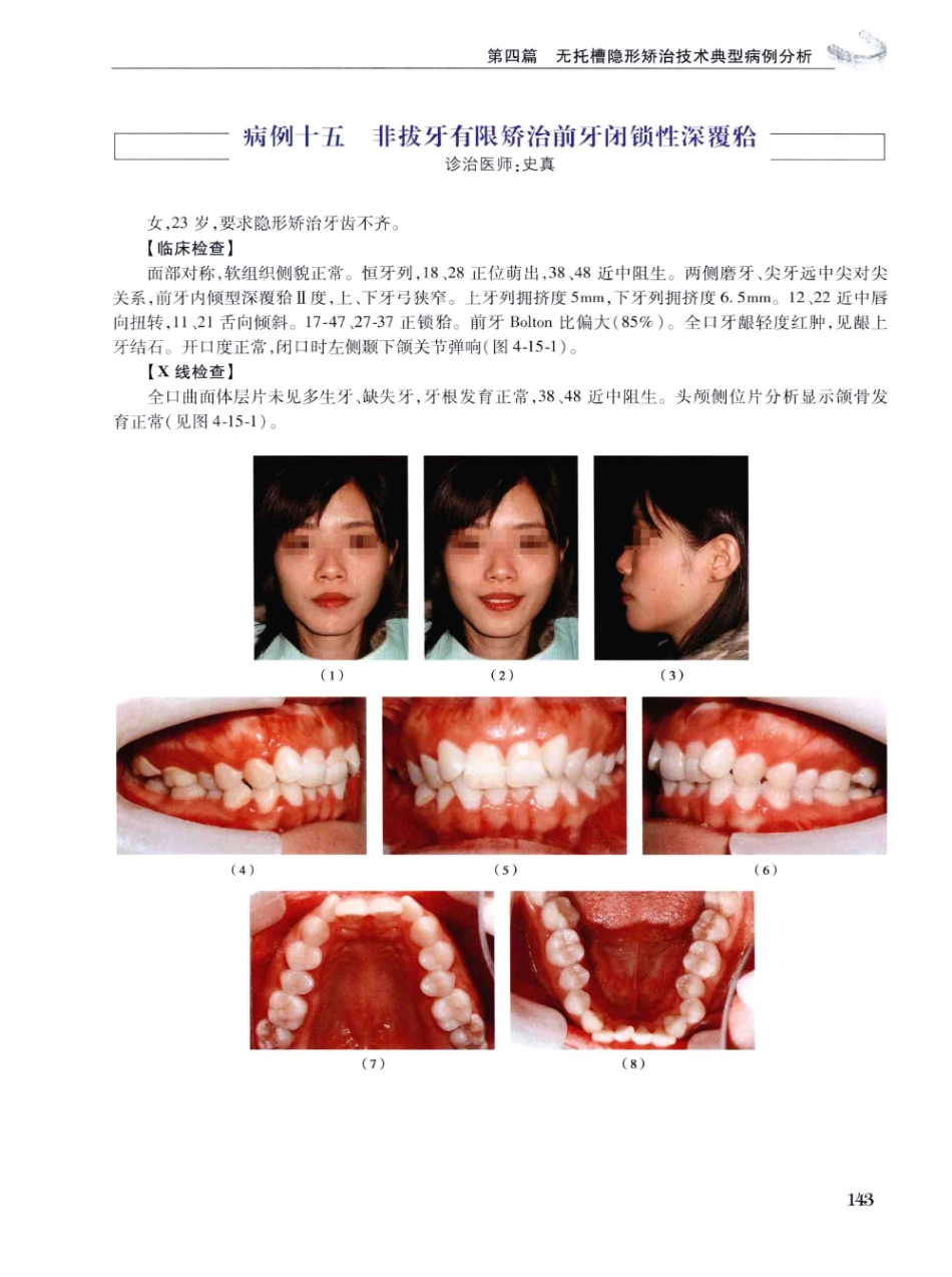 口腔正畸现代无托槽隐形矫治技术 田杰著 2014_157-168.pdf_第1页