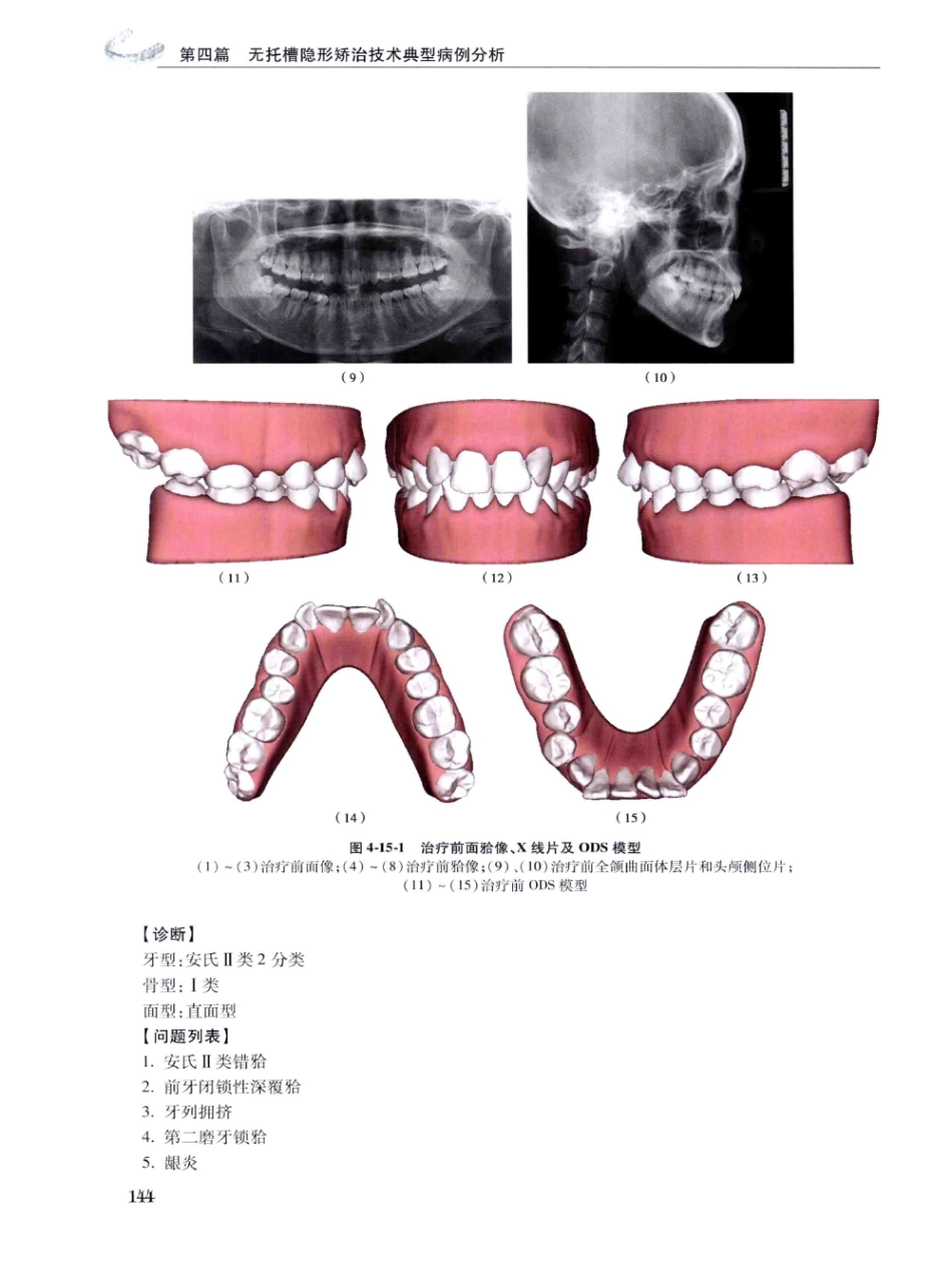 口腔正畸现代无托槽隐形矫治技术 田杰著 2014_157-168.pdf_第2页