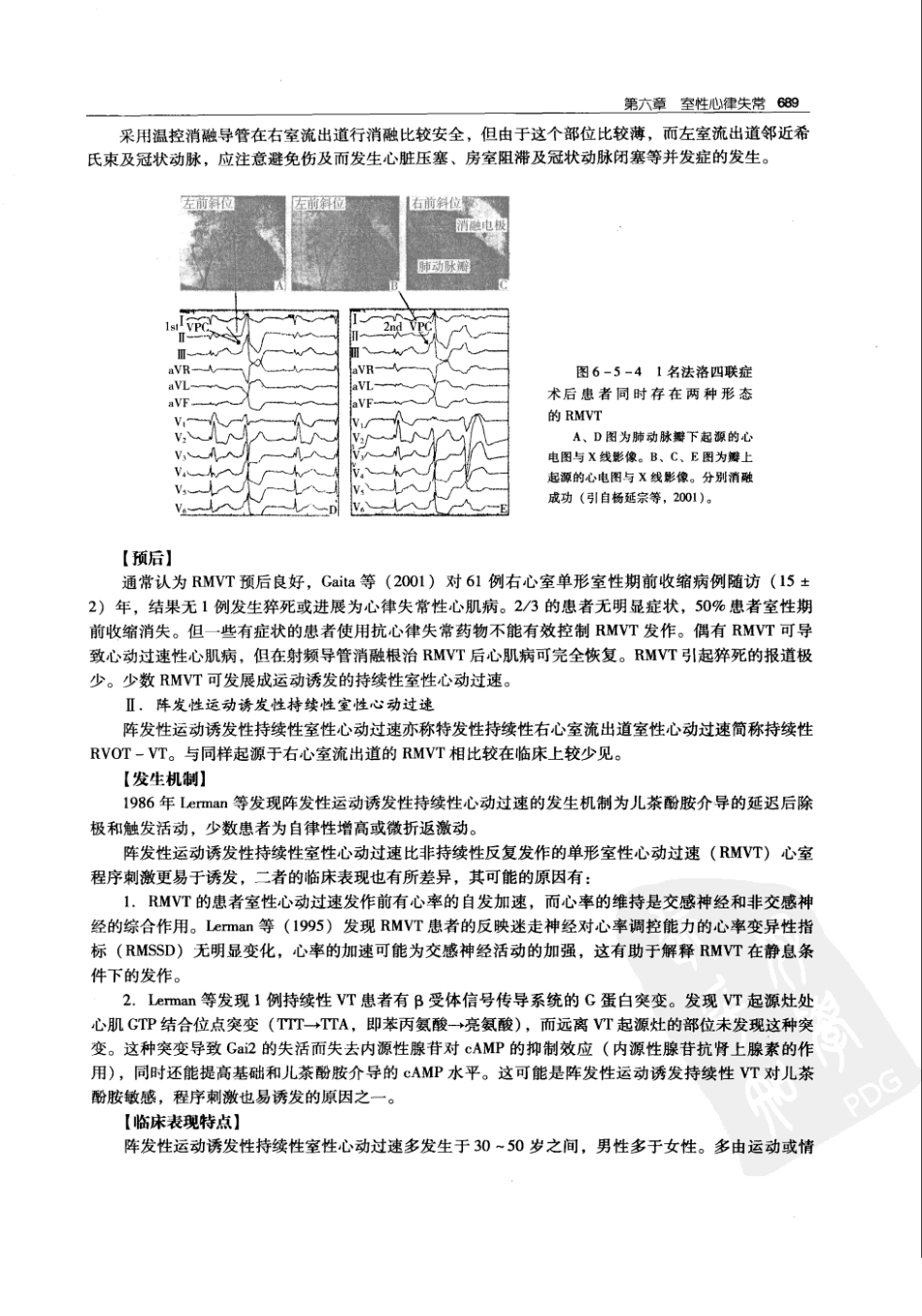 实用心律失常学：1100例心电图个案临床分析  第2版_中国协和医科大学出版社_2008.10_夏宏器，邓开伯主编_701-750.pdf_第1页