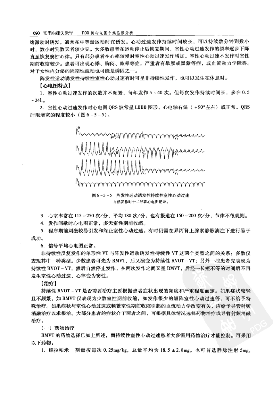 实用心律失常学：1100例心电图个案临床分析  第2版_中国协和医科大学出版社_2008.10_夏宏器，邓开伯主编_701-750.pdf_第2页