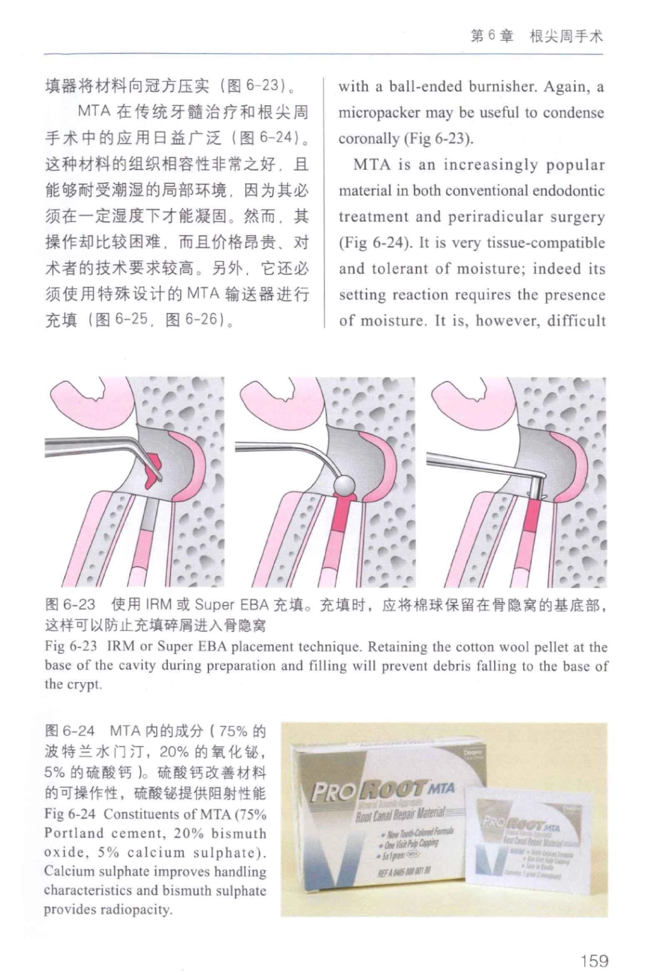 牙周手术临床指南 中英文对照_俞雪芬2013（彩图）_169-180.pdf_第1页