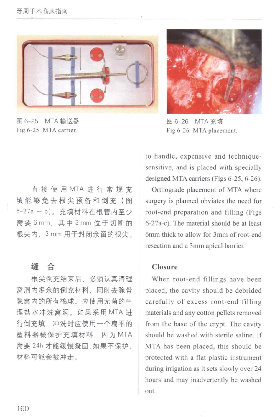 牙周手术临床指南 中英文对照_俞雪芬2013（彩图）_169-180.pdf_第2页