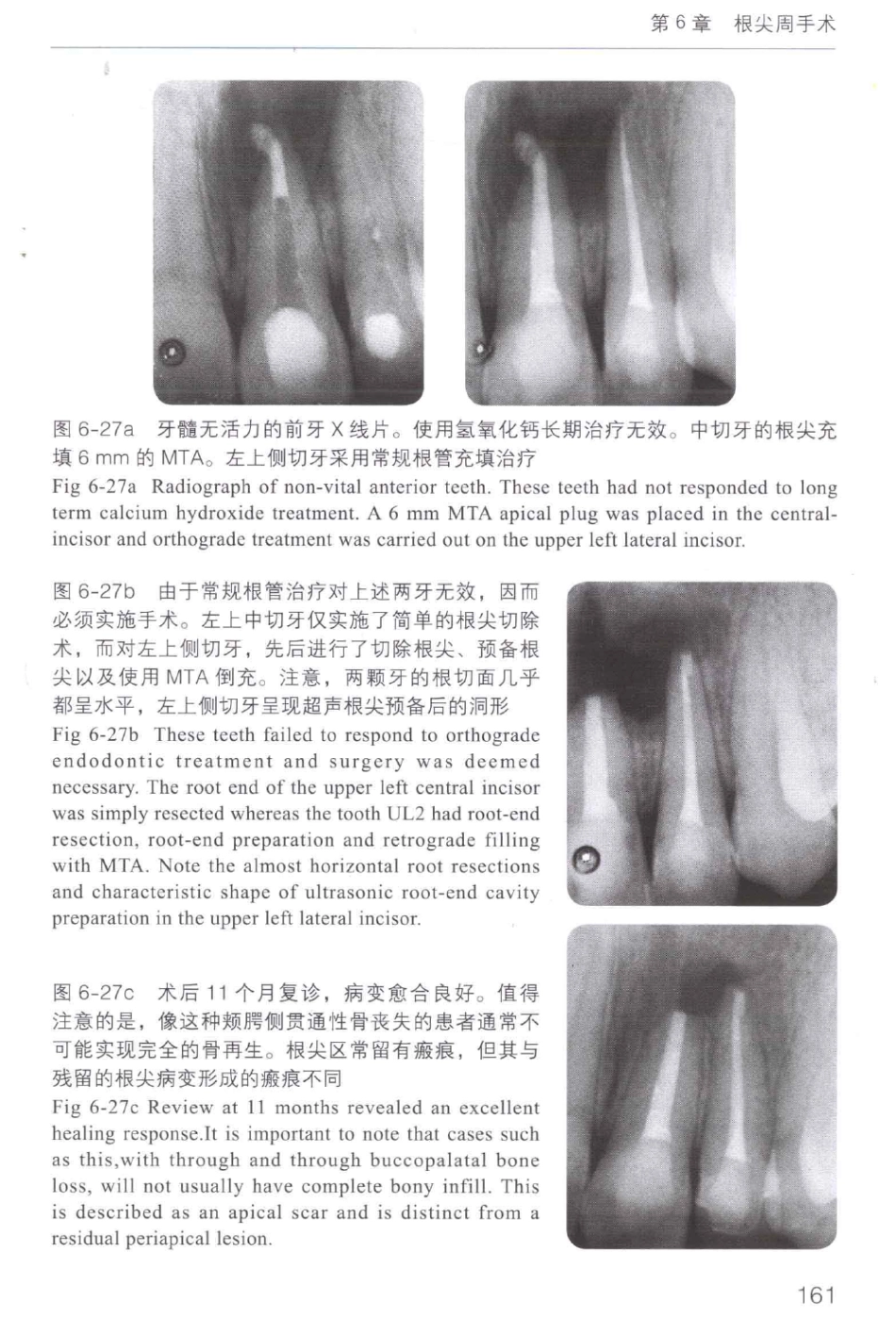 牙周手术临床指南 中英文对照_俞雪芬2013（彩图）_169-180.pdf_第3页