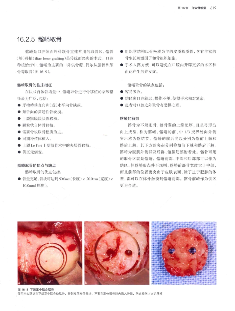 口腔种植学（第2版）_宿玉成主编_2014年（彩图）_661-690.pdf_第2页