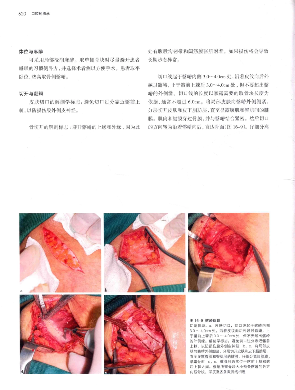 口腔种植学（第2版）_宿玉成主编_2014年（彩图）_661-690.pdf_第3页