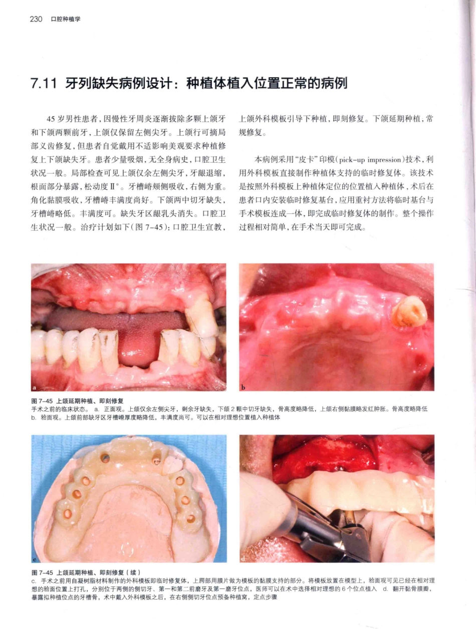 口腔种植学（第2版）_宿玉成主编_2014年（彩图）_271-300.pdf_第3页