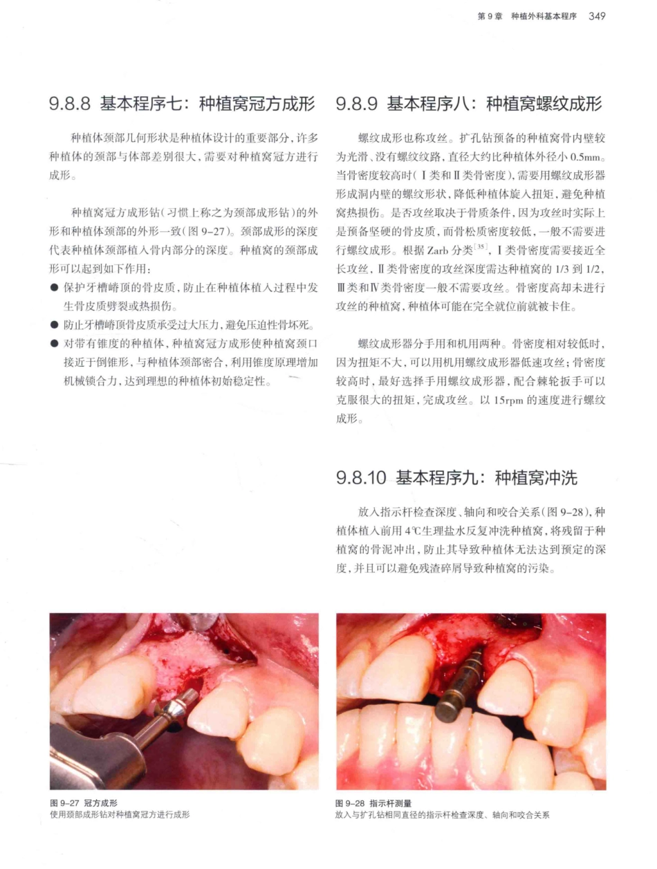 口腔种植学（第2版）_宿玉成主编_2014年（彩图）_391-420.pdf_第2页