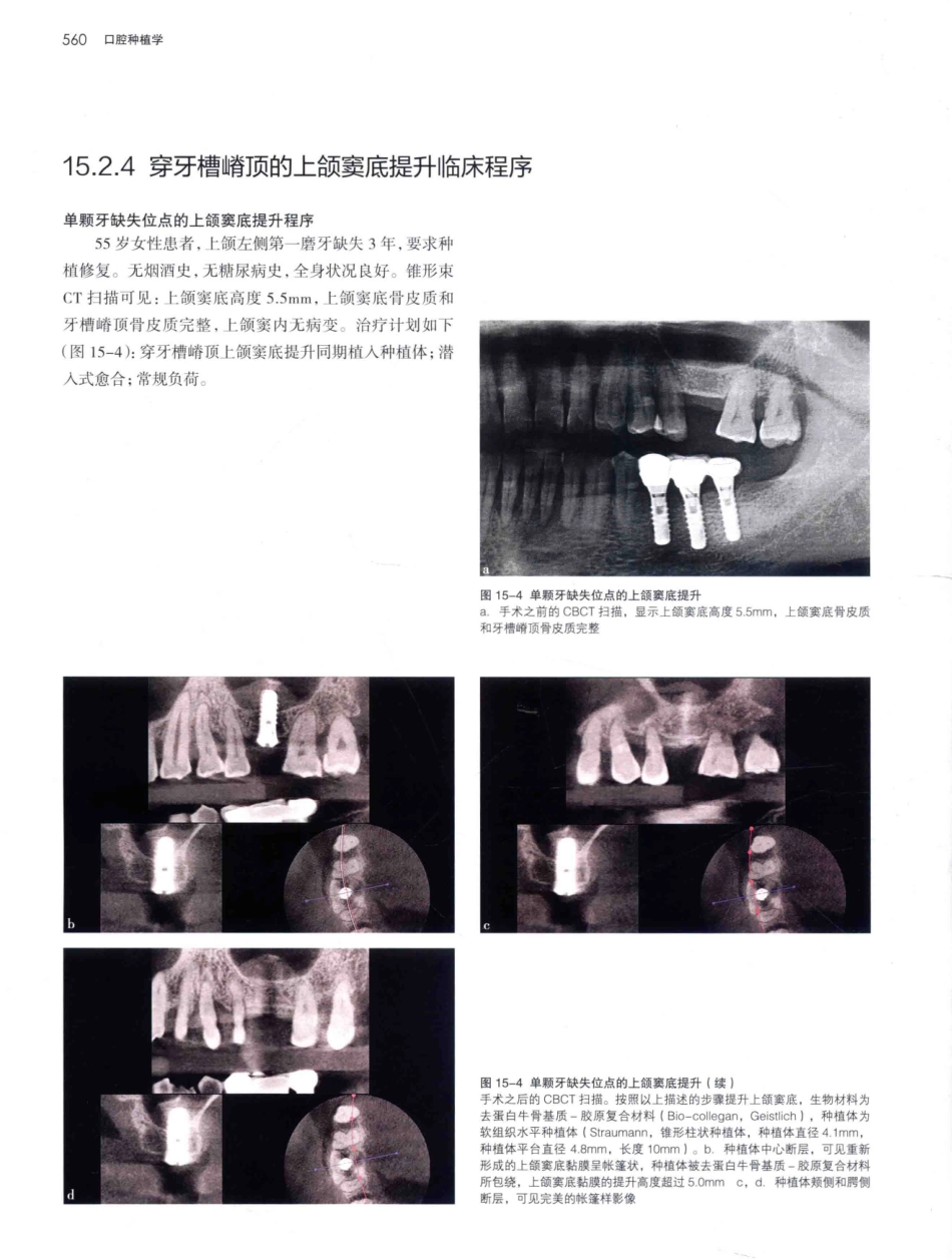 口腔种植学（第2版）_宿玉成主编_2014年（彩图）_601-630.pdf_第3页