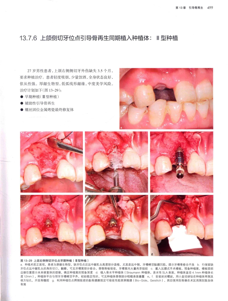 口腔种植学（第2版）_宿玉成主编_2014年（彩图）_541-570.pdf_第2页