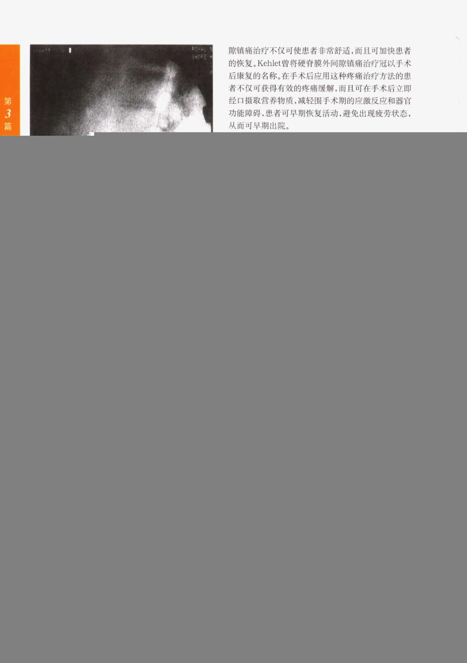 临床局部麻醉技术_601-621.pdf_第1页