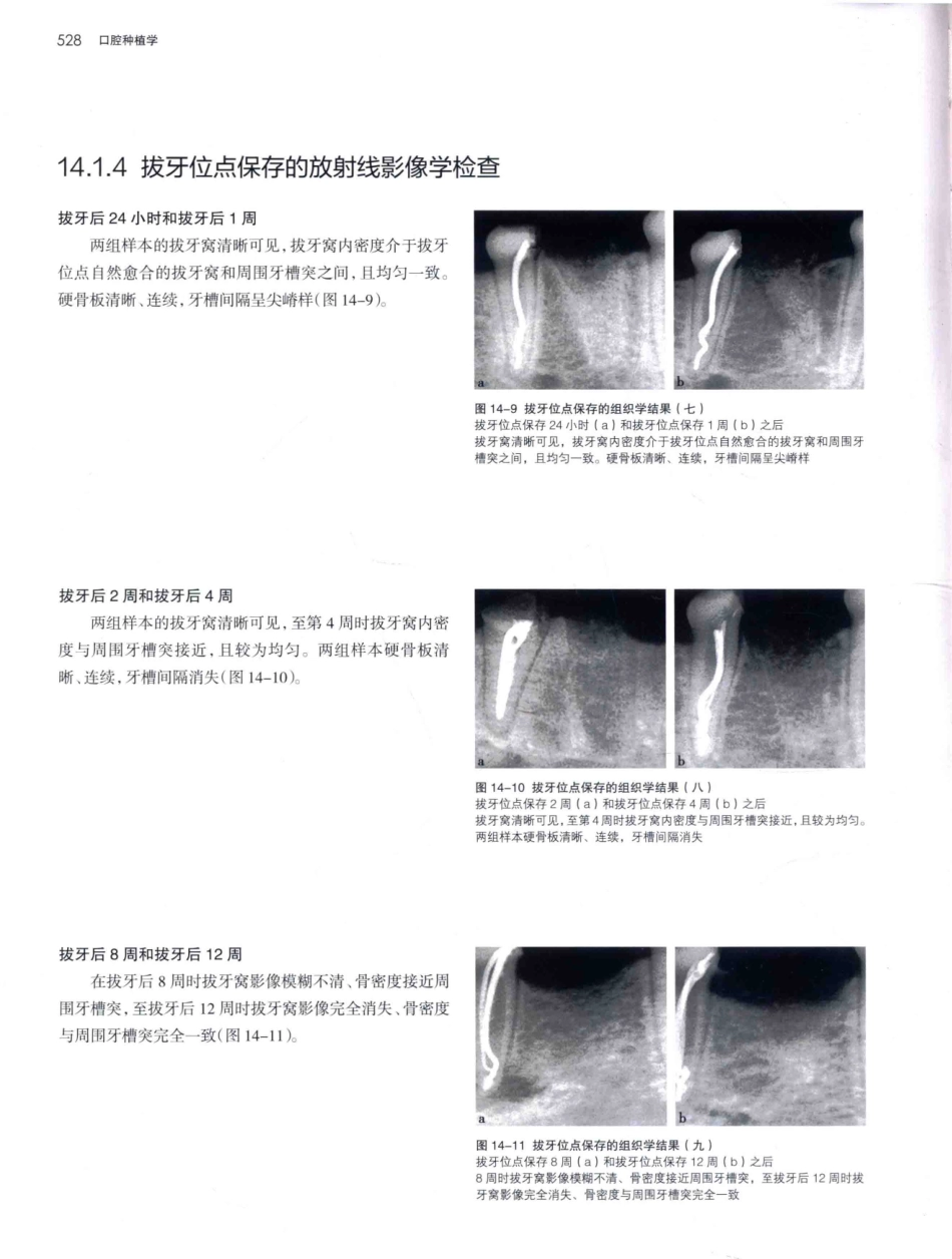 口腔种植学（第2版）_宿玉成主编_2014年（彩图）_571-600.pdf_第1页