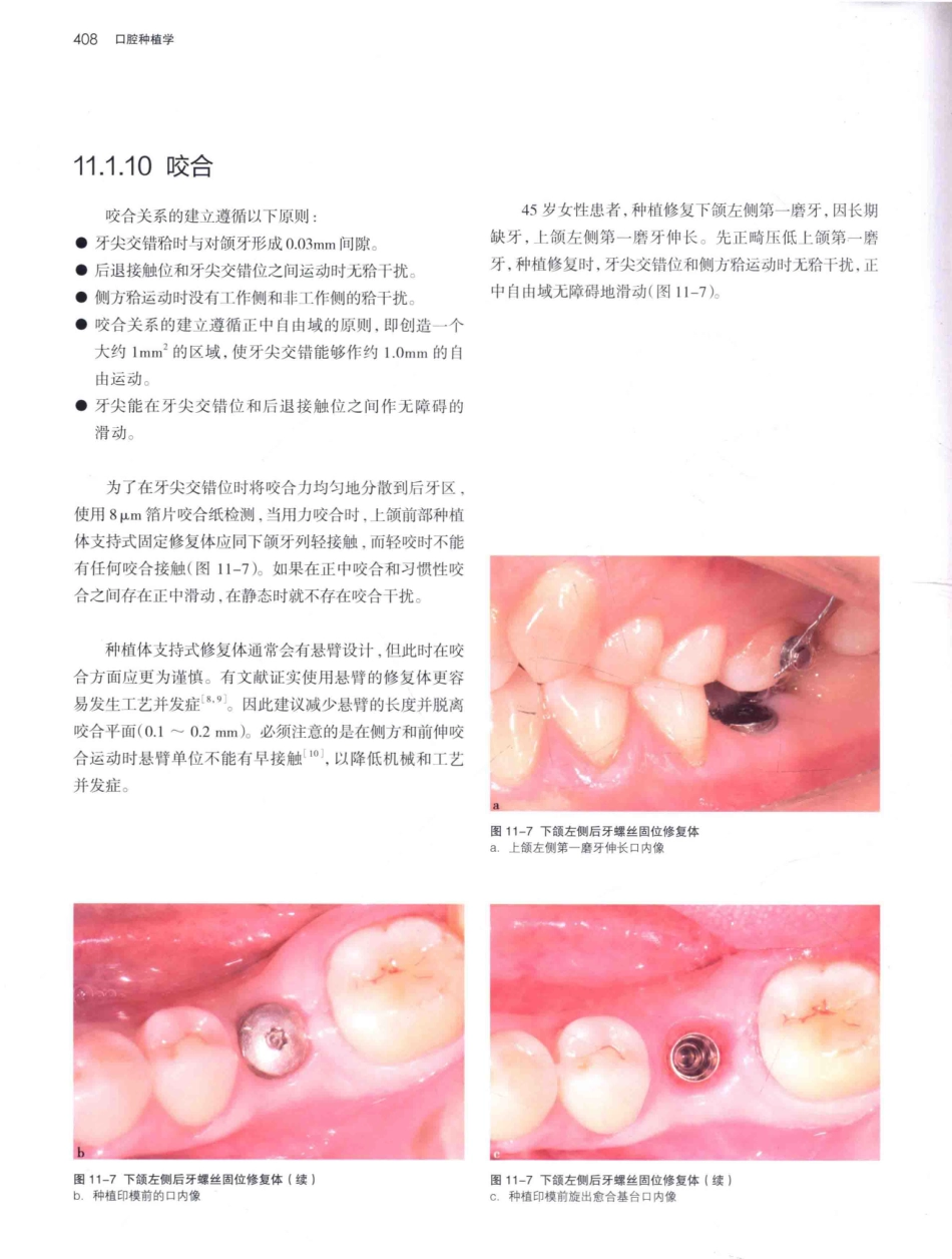 口腔种植学（第2版）_宿玉成主编_2014年（彩图）_451-480.pdf_第1页
