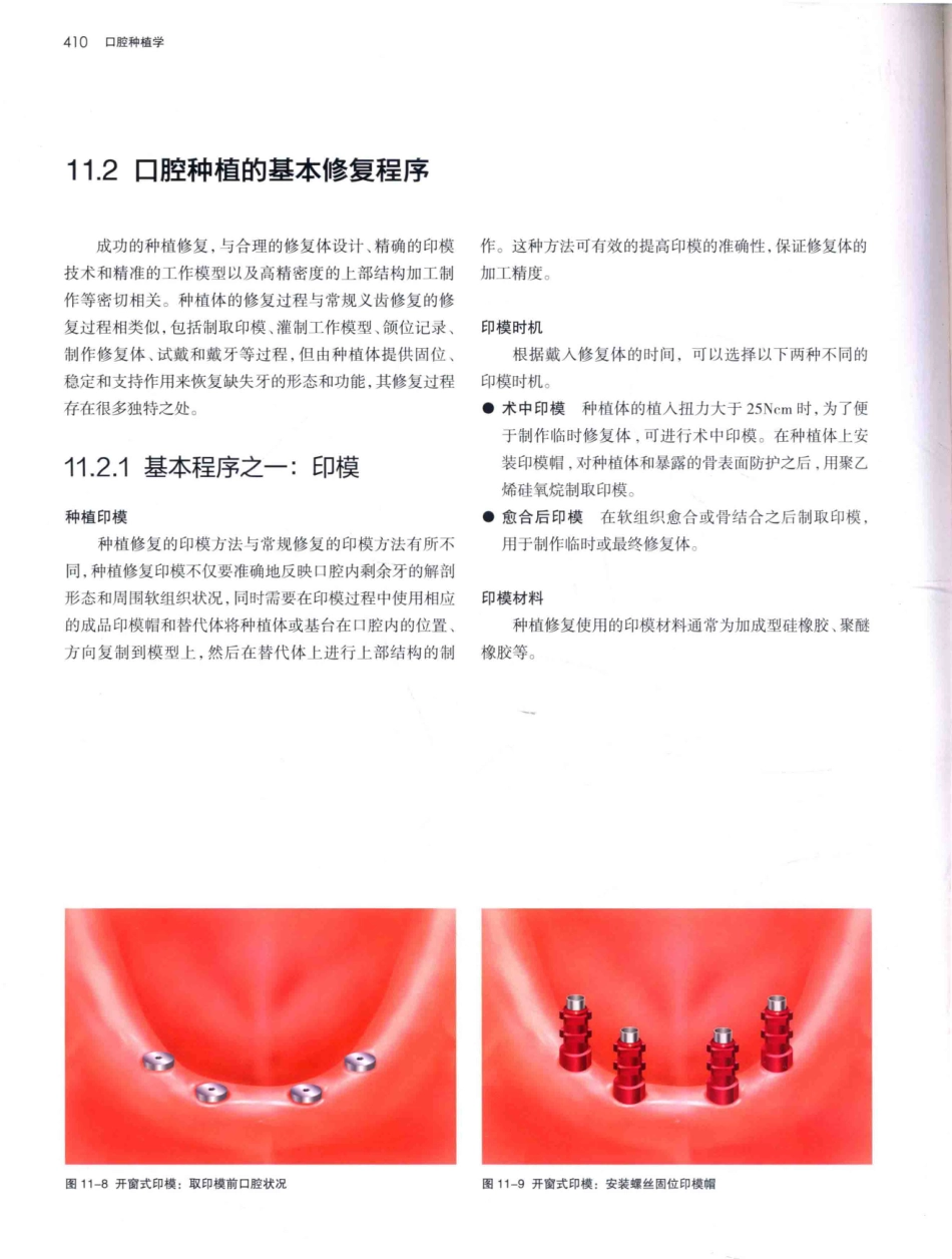 口腔种植学（第2版）_宿玉成主编_2014年（彩图）_451-480.pdf_第3页