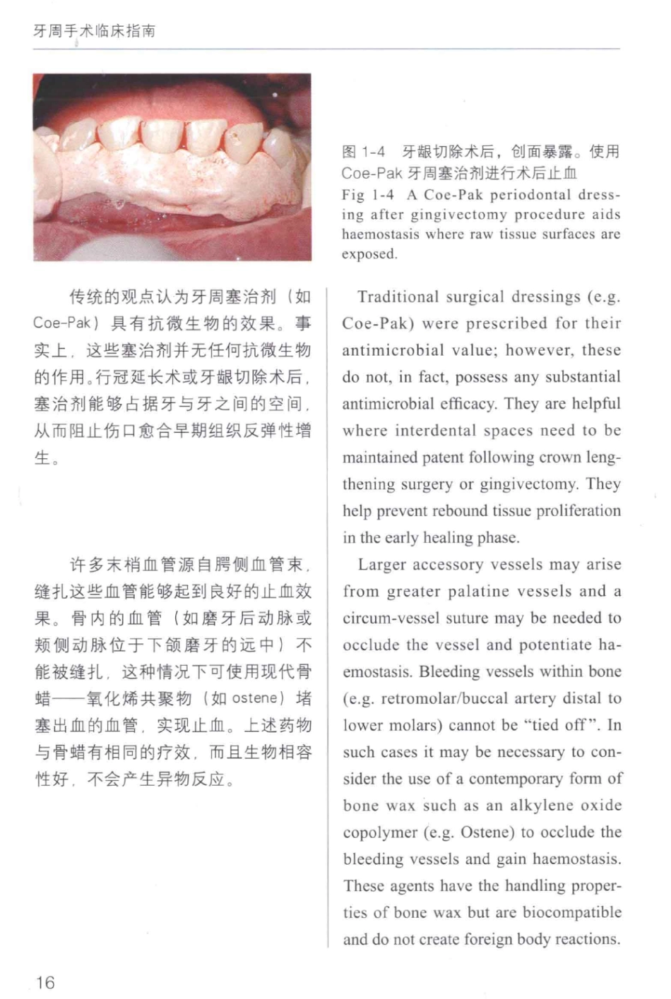 牙周手术临床指南 中英文对照_俞雪芬2013（彩图）_25-36.pdf_第2页